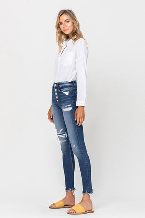 Parkside High Rise Patched Button Up Skinny Jeans (DS) FG